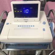 CTG (kardiotokografija)